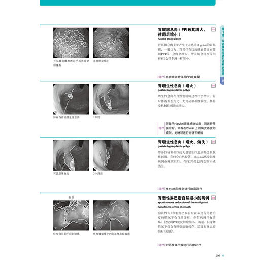内镜图像的诊断与鉴别诊断图谱 上消化道（第3三版）戎龙 年卫东 周斌 主译 消化内镜入门规范内镜诊断图谱书籍辽宁科学技术出版社 商品图3