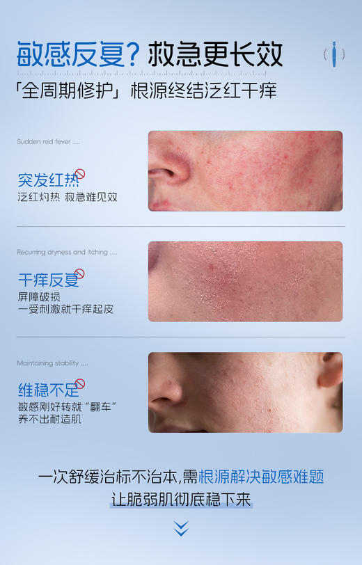 【老客专属福利】NACO维生素原B5舒敏闪修特护次抛精华液30支/盒+玻尿酸水光嫩颜次抛精华液1.2ml*30支 #润肤修复维稳组合装 #褪红热·修敏糙·调肌底 修护敏肌 商品图6