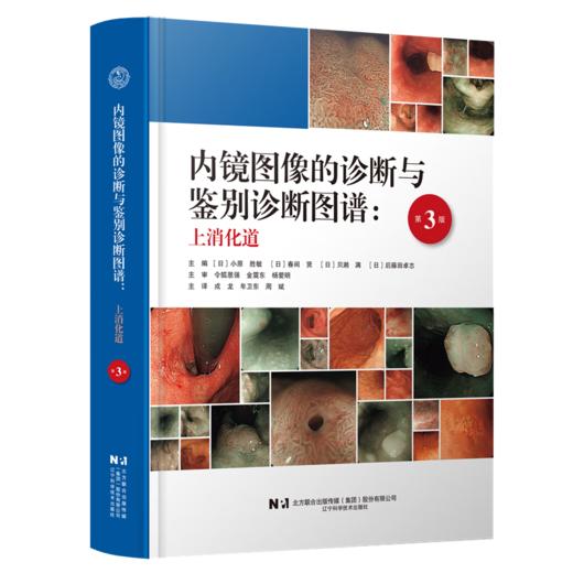 内镜图像的诊断与鉴别诊断图谱 上消化道（第3三版）戎龙 年卫东 周斌 主译 消化内镜入门规范内镜诊断图谱书籍辽宁科学技术出版社 商品图1