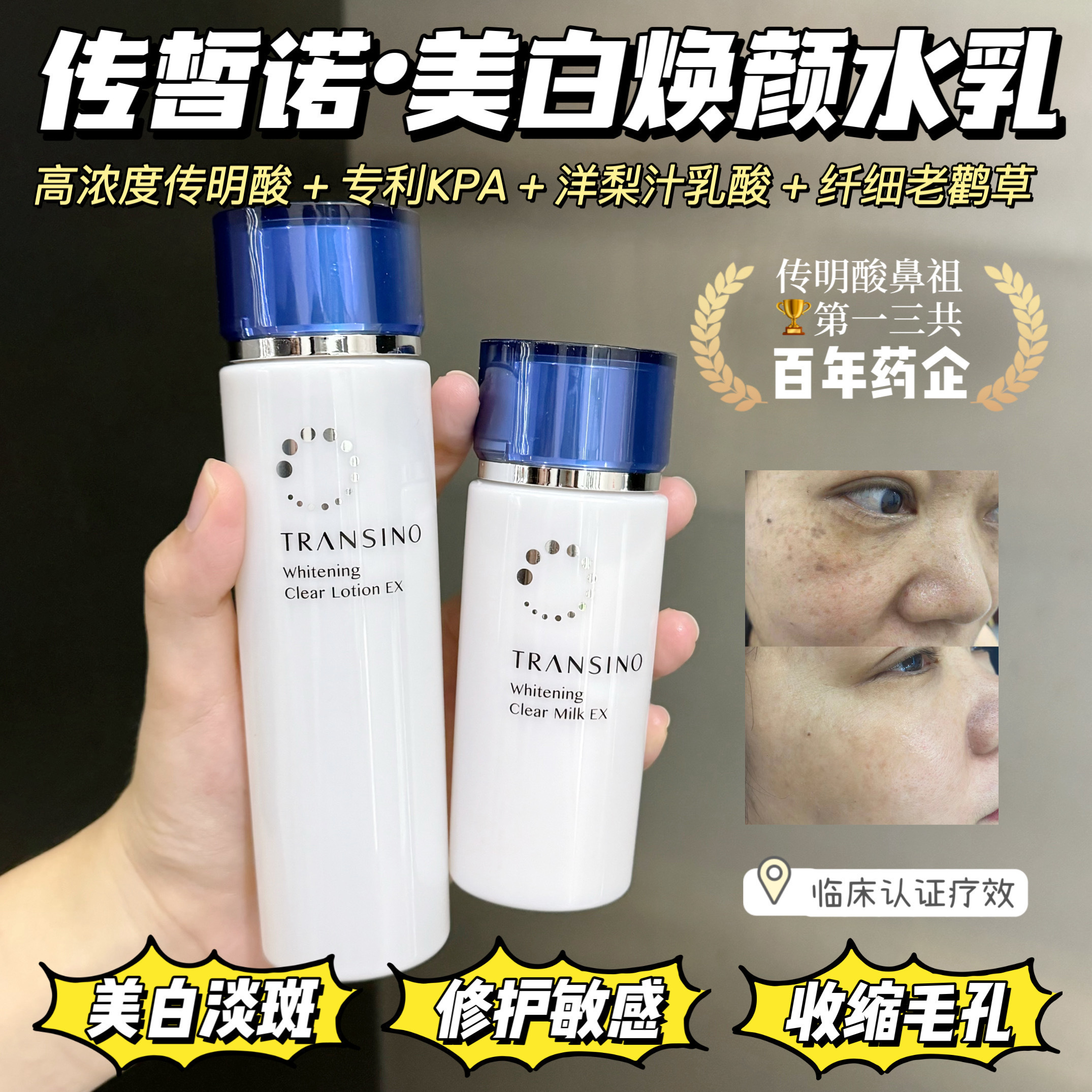 原价 800 一套‼️特价不到三折‼️传明酸鼻祖✨临期特价【TRANSINO传皙诺美白焕颜修护面霜/水乳】持美白淡斑特证👉🏻 高浓度传明酸 + 专利KPA🏆源头击破黑色素⚡斑点粉碎机