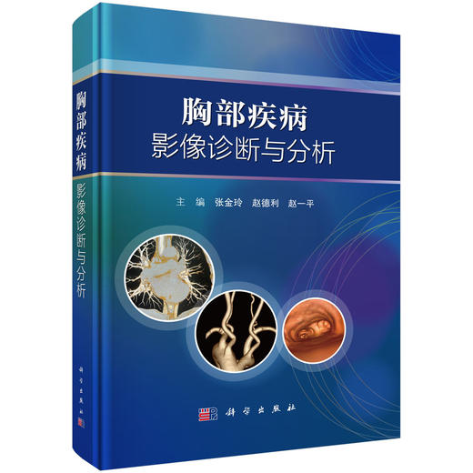 胸部疾病影像诊断与分析 商品图0