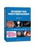 消化道黏膜下病变内镜诊疗图谱与经典病例 商品缩略图0