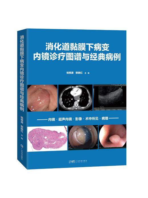 消化道黏膜下病变内镜诊疗图谱与经典病例 商品图0