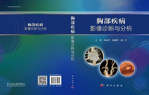 胸部疾病影像诊断与分析 商品图3
