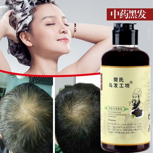 何首乌洗发水黑发养发液强健发根防脱育发 头发健康成长 商品图3