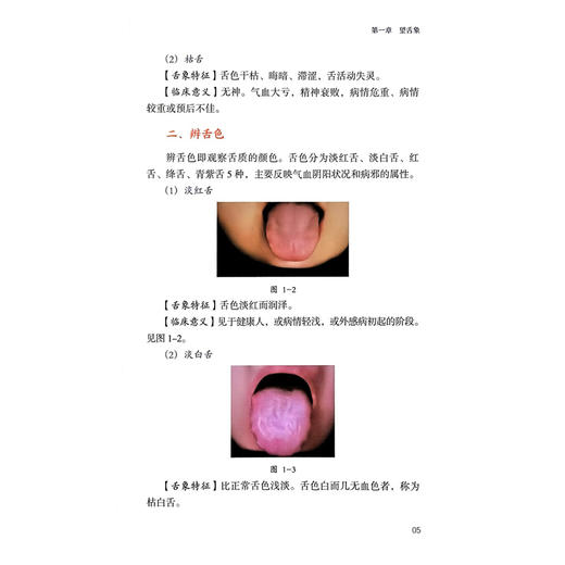 体质辨识舌诊图解 张哲 陈智慧 主编 详细解析了不同体质人群的诊断要点及其临床特征 高清彩图 9787559141750 辽宁科学技术出版社 商品图4