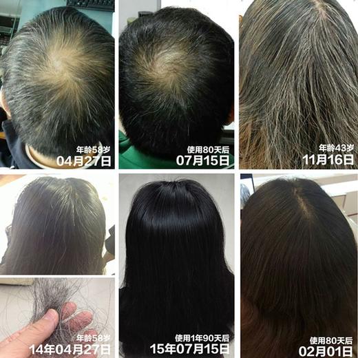 何首乌洗发水黑发养发液强健发根防脱育发 头发健康成长 商品图2