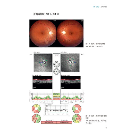中山眼底病疑难病例解析2025版（中山眼科疑难眼病系列）丁小燕 吕林 读者对象眼底病专科医生 眼科医生 眼科医学生人民卫生出版社 商品图4