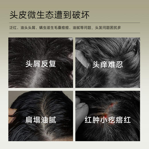 ⁴99元/2瓶加赠护发素【控油蓬松洗发水&滋养柔顺洗发水】YC04-CR-YK 商品图1