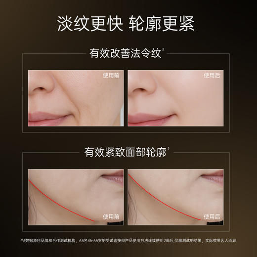 ⁴加送5g试用装【首发55%Dr.ZP玻色因面霜】50g 需手心乳化使用 YC04-CR-YK【HOT】 商品图2