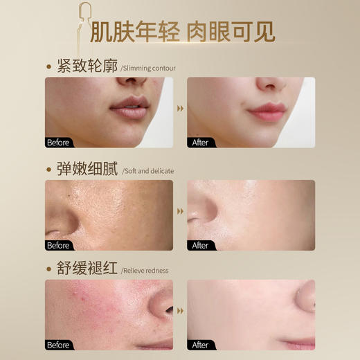 ⁴加赠体验装【小金针玻色因精华次抛精华液】无水配方玻色因+依克多因+胶原+透明质酸钠+二裂酵母发酵液+积雪草 YC04-CR-YK 商品图3