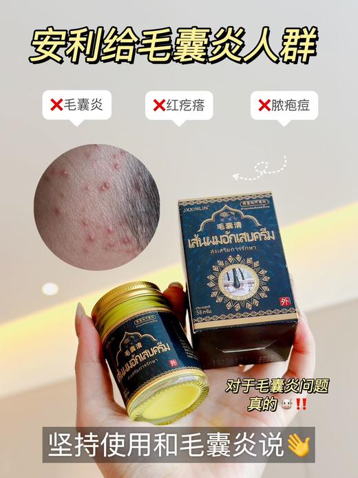 【JXXINLIN.泰国 毛囊清】专门针对皮炎长痘、痤疮、湿疹、敏感性皮肤引起的 商品图3