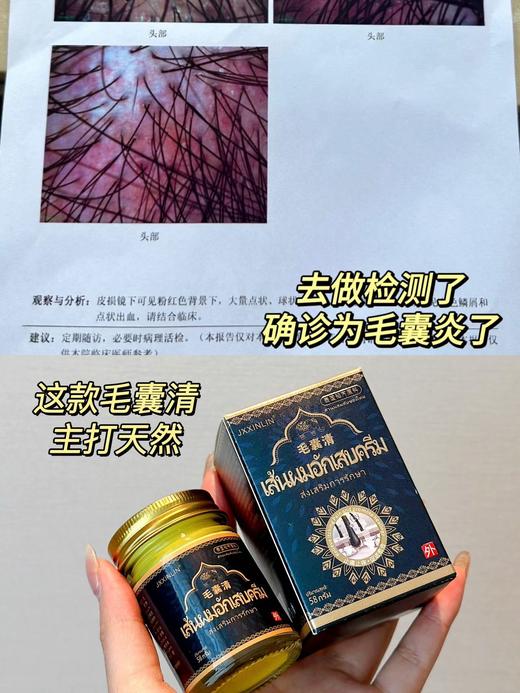 【JXXINLIN.泰国 毛囊清】专门针对皮炎长痘、痤疮、湿疹、敏感性皮肤引起的 商品图5
