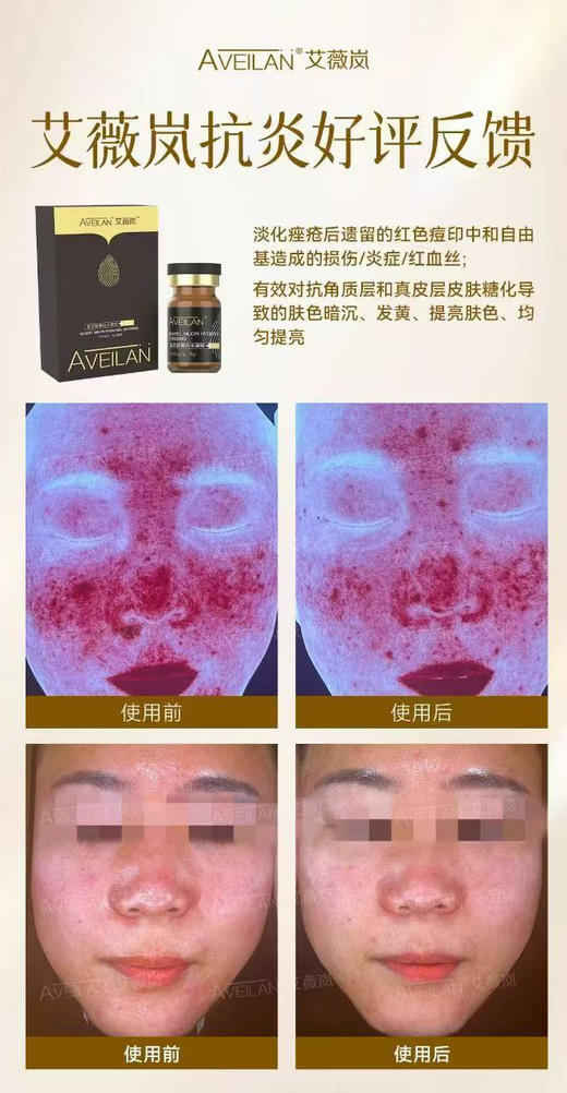 艾薇岚深海修复黑瓶抗yan修复 贻贝粘蛋白含1500ug/退红舒缓敏感 商品图0