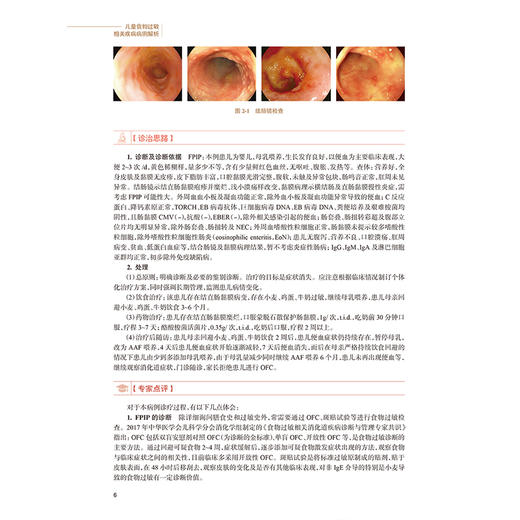 儿童食物过敏相关疾病病例解析 吴捷 龚四堂 江米足 为儿科医师提供理论和实践基础 充分指导临床实践9787117391566人民卫生出版社 商品图4