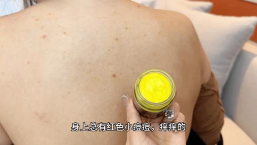 【JXXINLIN.泰国 毛囊清】专门针对皮炎长痘、痤疮、湿疹、敏感性皮肤引起的 商品图1