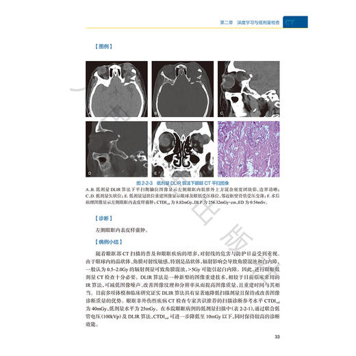 CT深度学习图像重建技术与临床应用 高剑波 吕培杰 本书主要阐述了DLIR算法在各部位疾病检查中的临床应用等 人民卫生出版社 商品图4