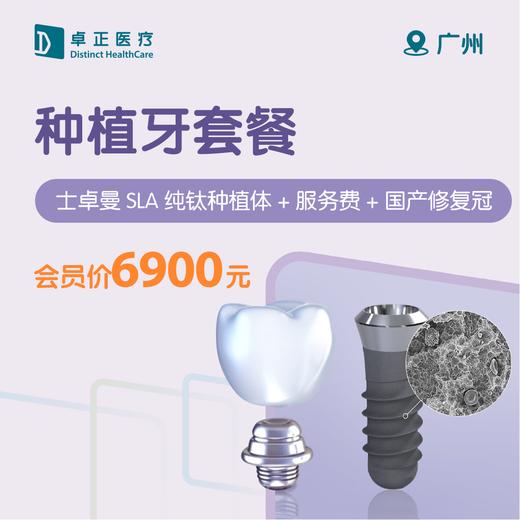 广州种植牙套餐（士卓曼SLA种植体/颗+服务费+国产修复冠） 商品图0