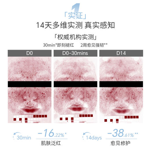 【舒润速修护  解救干敏肌】5100极地冰泉舒缓特护喷雾  强韧润护   舒缓干红起皮 商品图2