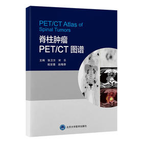 脊柱肿瘤 PET/CT 图谱  主编： 张卫方　宋　乐　祝安惠　赵梅莘  北医社