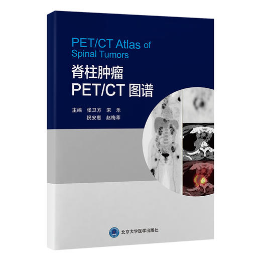 脊柱肿瘤 PET/CT 图谱  主编： 张卫方　宋　乐　祝安惠　赵梅莘  北医社 商品图0