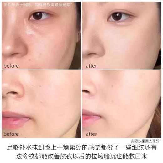 珀莱雅红宝石水乳洁面小美盒礼盒 商品图7