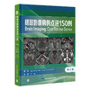 脑部影像病例点评150例  主译：卢洁 北医社 商品缩略图0