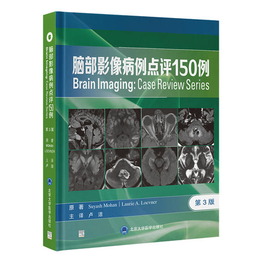 脑部影像病例点评150例  主译：卢洁 北医社 商品图0