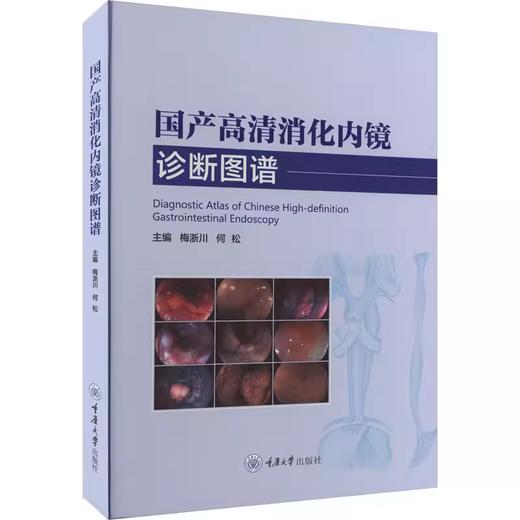 国产高清消化内镜诊断图谱 商品图0