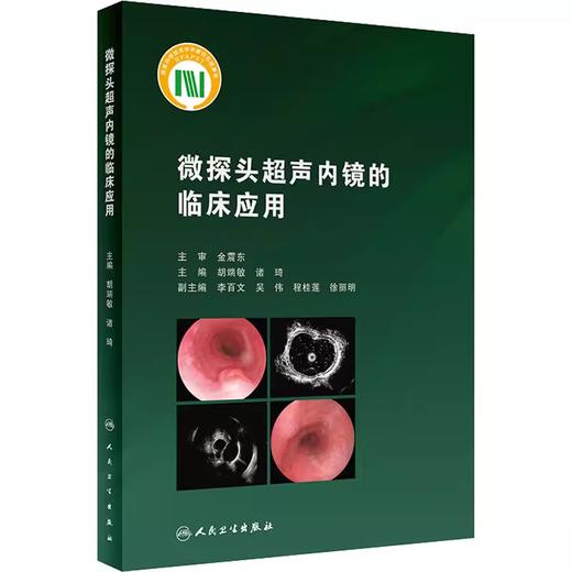微探头超声内镜的临床应用 商品图0