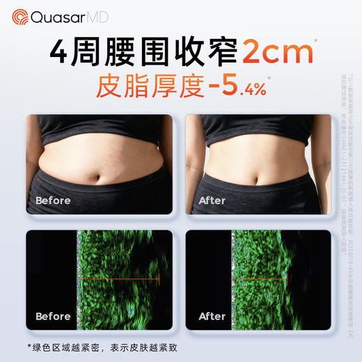 科施佳酷塑 女团腰 美团紧塑燃脂机一代 商品图3