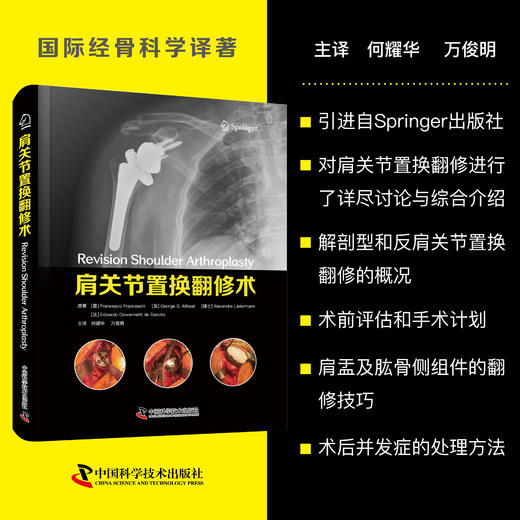 肩关节置换翻修术 商品图0