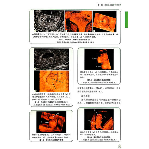 胎儿三维和四维超声的现状 熊奕 许晓华 主译 正常胎儿的解剖和发育 胎儿中枢神经系统等 9787523532300 科学技术文献出版社 商品图4