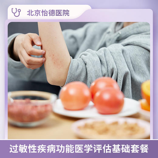 过敏性疾病功能医学评估基础套餐* 商品图0