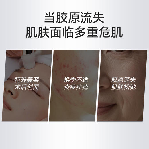 ZQ-II再启 医用重组胶原蛋白功能敷料30g（次抛30支）激光术后创面护理 商品图2