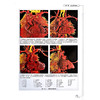 胎儿心血管铸型图谱 王瑜 邢辉 王斌 尹家保 主编 涵盖室间隔缺损、法洛四联症、大动脉转位等20余类畸形 科学技术文献出版社 商品缩略图4