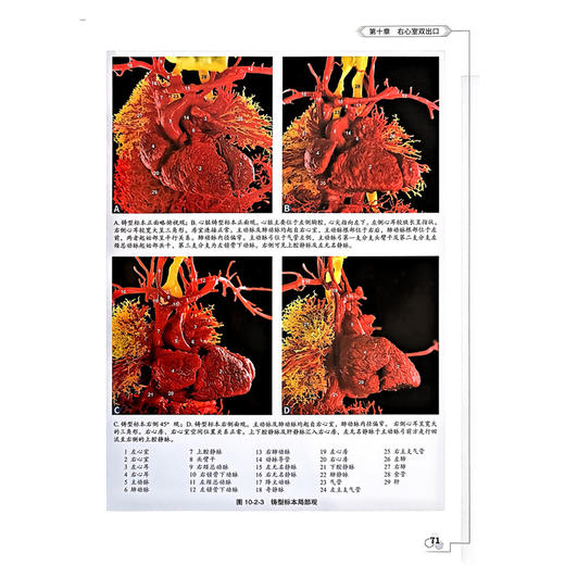 胎儿心血管铸型图谱 王瑜 邢辉 王斌 尹家保 主编 涵盖室间隔缺损、法洛四联症、大动脉转位等20余类畸形 科学技术文献出版社 商品图4