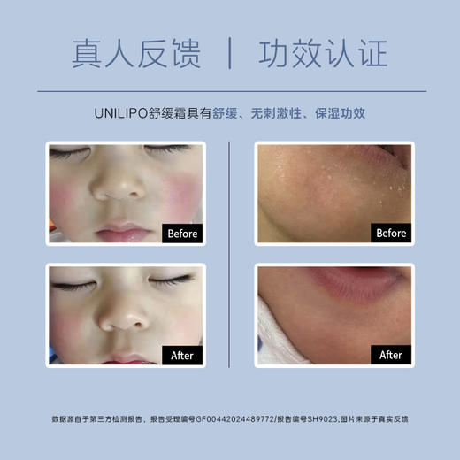【直击皮肤敏*红*痒】UNILIPO研知有理 小黄鸭舒缓霜30克 商品图2