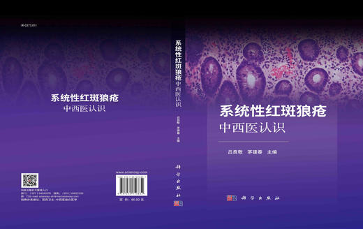 系统性红斑狼疮中西医认识 商品图3