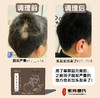 【冰老师】体质膏方，专属服务，配合饮食指导，直接下单不发货 商品缩略图11