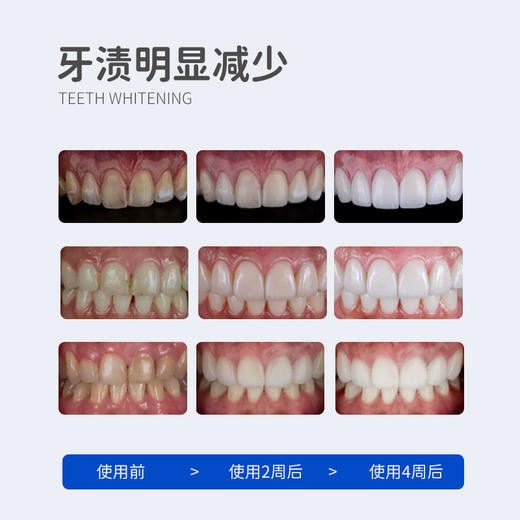 壹白清新系列牙膏| 100g/支 商品图11