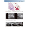 实用乳腺超声诊断与介入治疗 孙彦 崔立刚 蒋洁 主编 系统介绍乳腺超声诊断与介入技术的临床应用9787565935695北京大学医学出版社 商品缩略图4