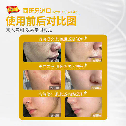 安茹光甘草定亮肤水光液可涂抹提亮祛黄暗沉抗氧安瓶 商品图1