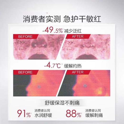 薇诺娜舒敏保湿特护面膜敏感肌补水舒缓泛红干燥脱屑修护强韧屏障 商品图2