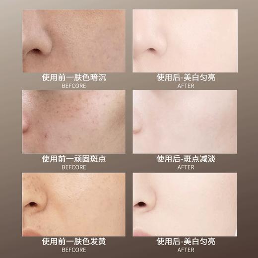科图尔祛斑美白系列 美白水+美白乳+美白霜+肌底液  买十送一 商品图3