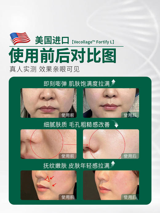 安茹三型胶原蛋白水光液可涂抹抗衰老收缩毛孔保湿嫩肤 商品图1