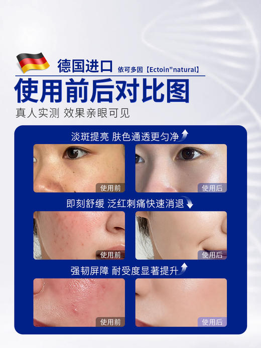 安茹依可多因屏护水光液可涂抹屏障修复舒缓泛红干皮补水 商品图1