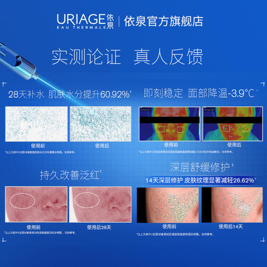 依泉多效修护活泉喷雾300ml  舒缓肌肤 爽肤水化妆水 商品图4