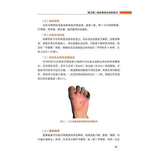 血管保卫战：血栓闭塞性脉管炎治疗精要 杜猛 王耿 姚陈 李普升 主编 中西医融合 精准诊疗 全程管理等 科学技术文献出版社 商品图4