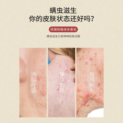 【保湿滋养❗除螨净肤】硫磺除螨液体香皂除螨沐浴露液体香皂家用清洁洗澡净螨硫磺沐浴露。xa 商品图1